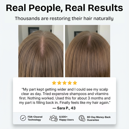 AuraCell GrowBrush Red Light Hair Growth Brush – 630nm LEDs for Thinning Hair & Scalp Health