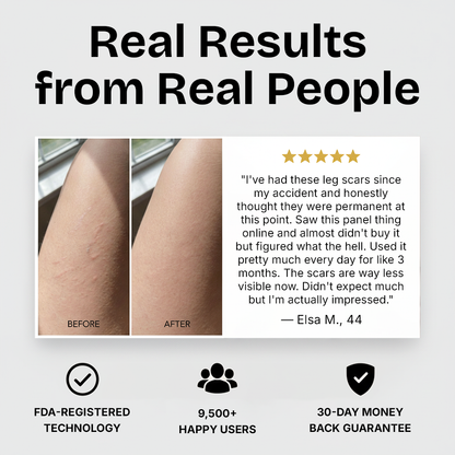 AuraCell Red Light Therapy Body Panel with 660nm & 850nm Near-Infrared – Full Back Pain Relief & Skin Tightening